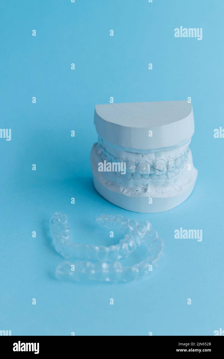 Dental plaster mold and orthodontic silicone trainer Stock Photo Alamy