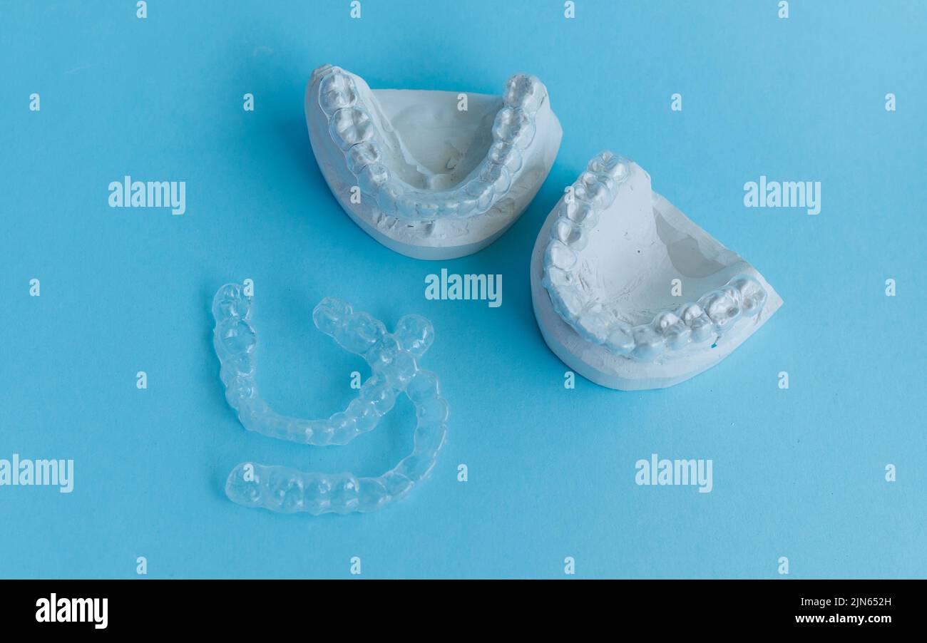 Model jaws with orthodontic silicone trainer on blue background Stock