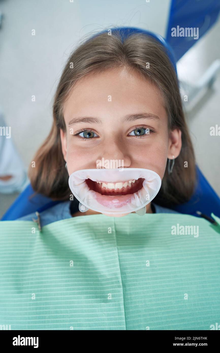 Patient with cheek retractor lying in dentist office Stock Photo Alamy