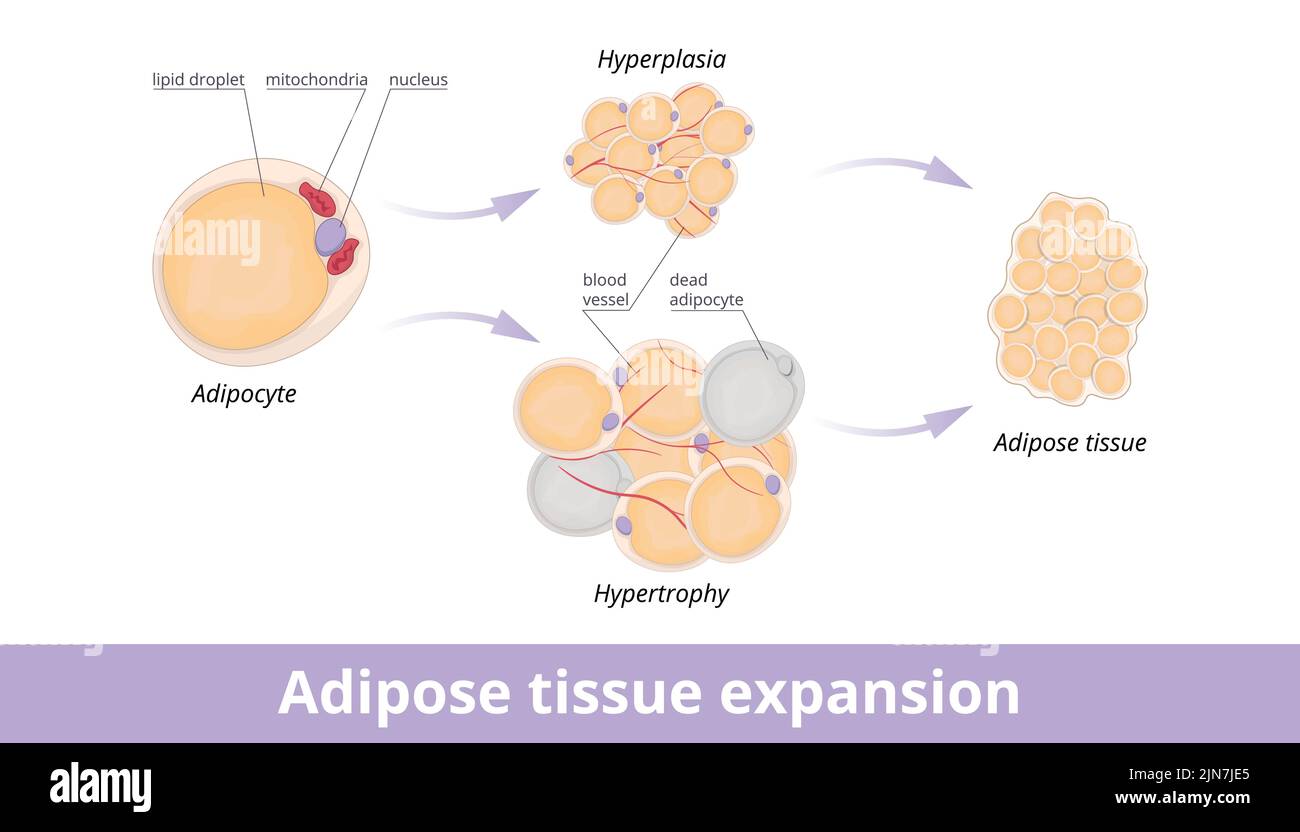 Adipose tissue expansion. Mechanisms of adipose tissue expansion: hypertrophic and hyperplasic adipose. Hypertrophic and hyperplasic fat cells Stock Vector