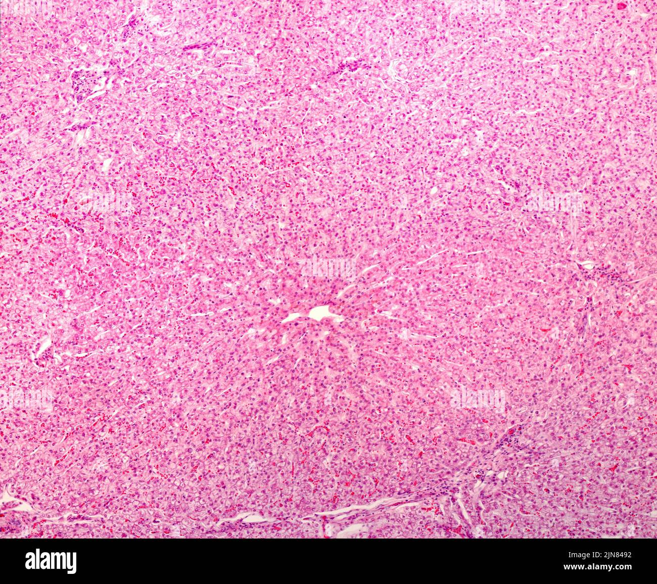 Human liver lobule, light micrograph Stock Photo - Alamy