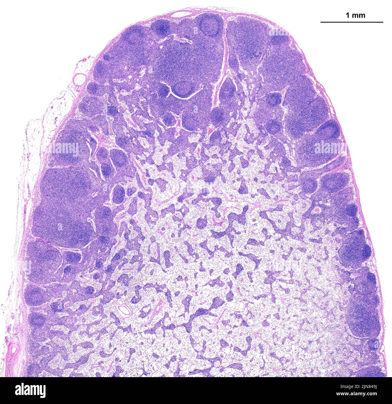 Human lymph node, light micrograph Stock Photo - Alamy