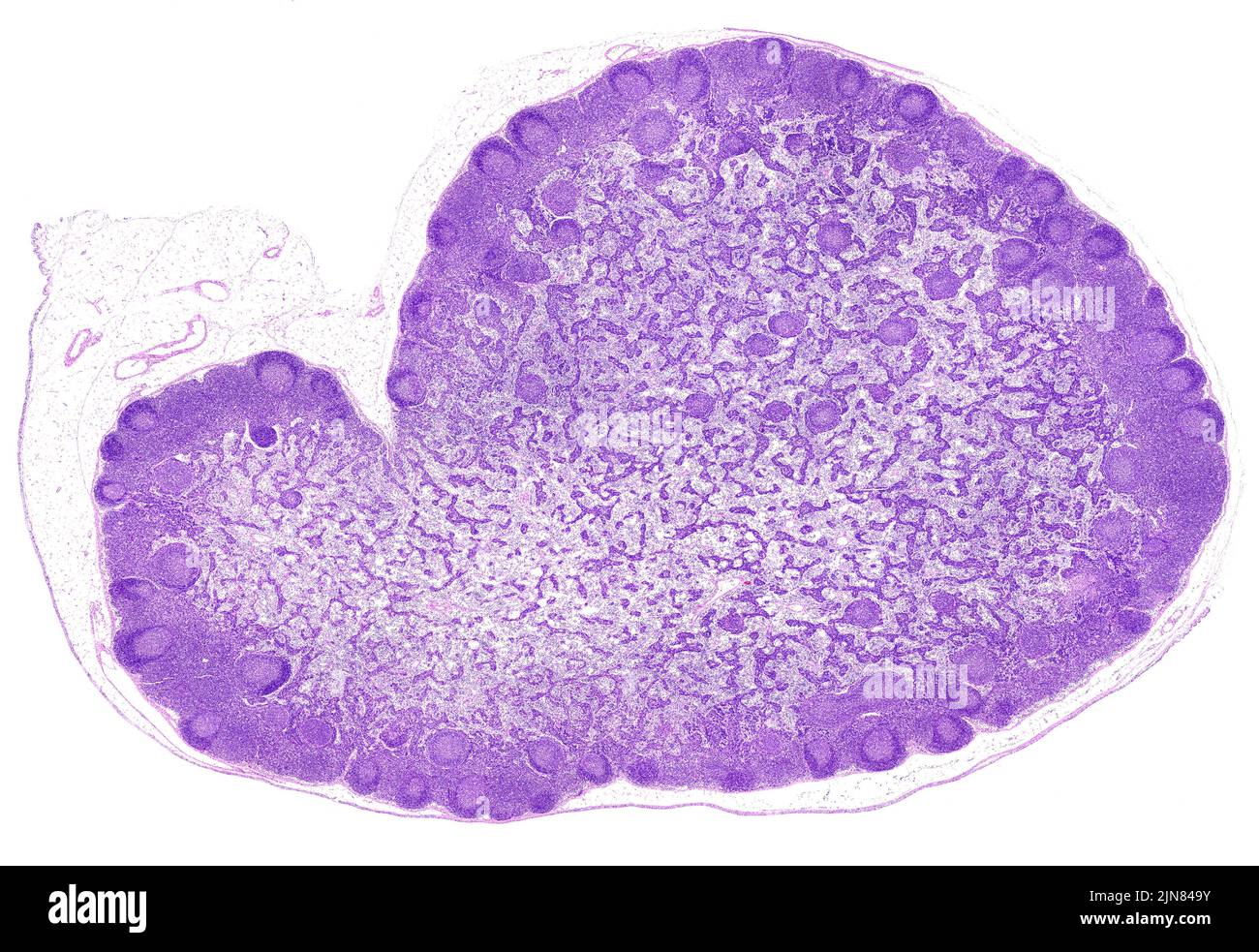 Lymph node, light micrograph Stock Photo - Alamy