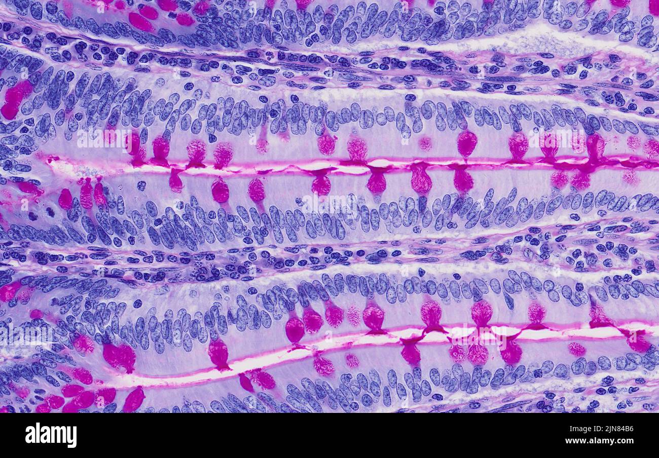 Small intestine, light micrograph Stock Photo Alamy