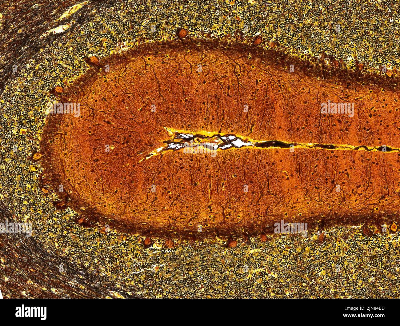 Brain tissue, light micrograph Stock Photo - Alamy
