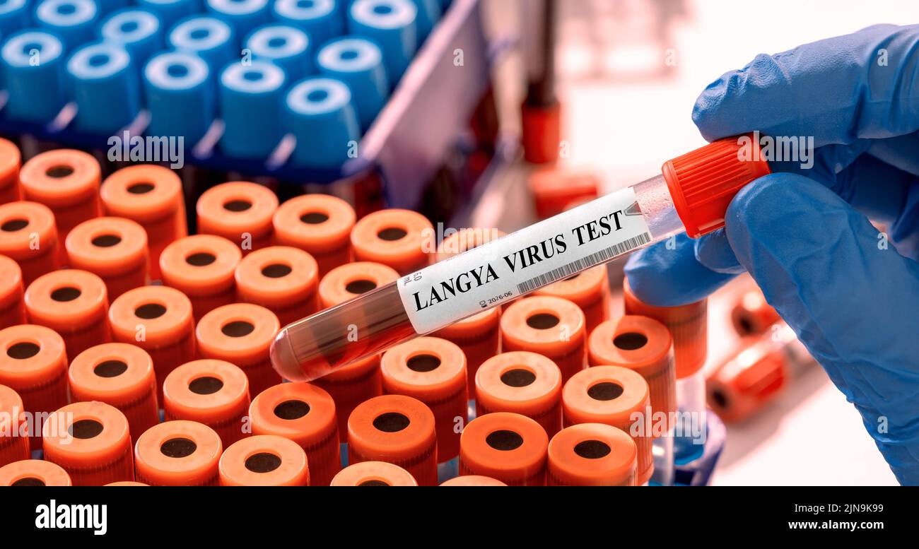 langya virus test tube in microbiological laboratory Stock Photo