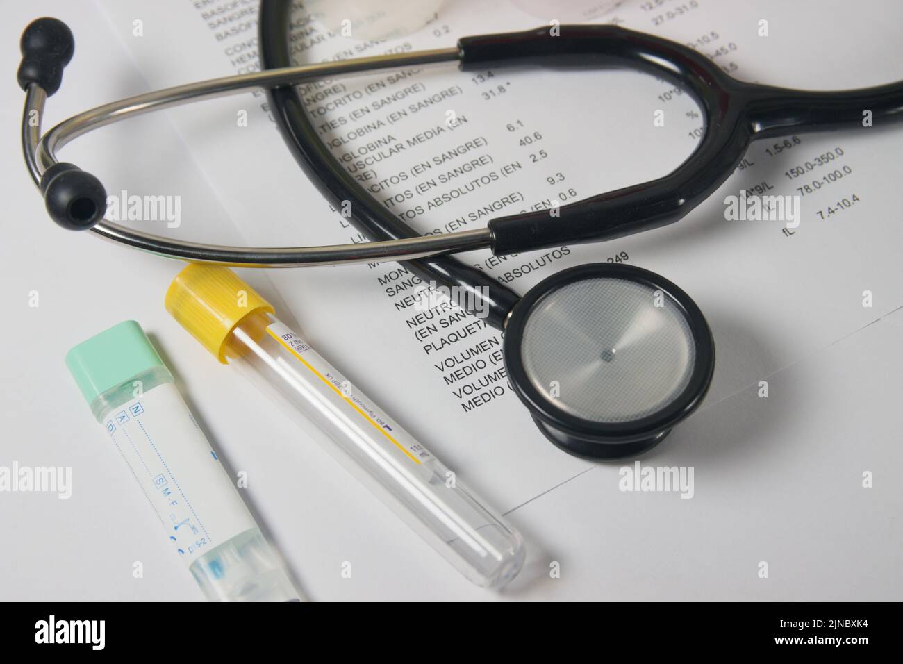 A doctor's stethoscope sits on top of blood test results printouts, along with containers for collecting urine and fecal occult blood samples Stock Photo