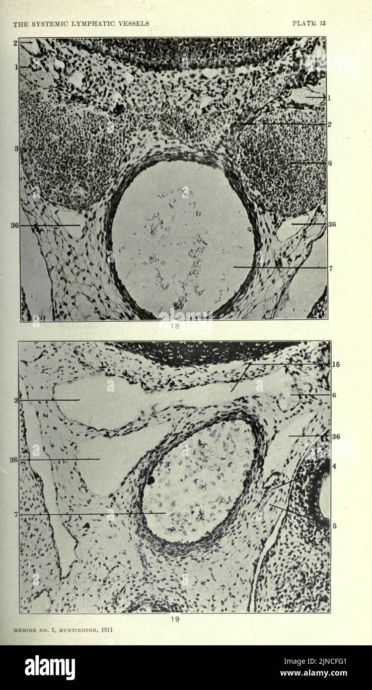 The anatomy and development of the systemic lymphatic vessels in the ...