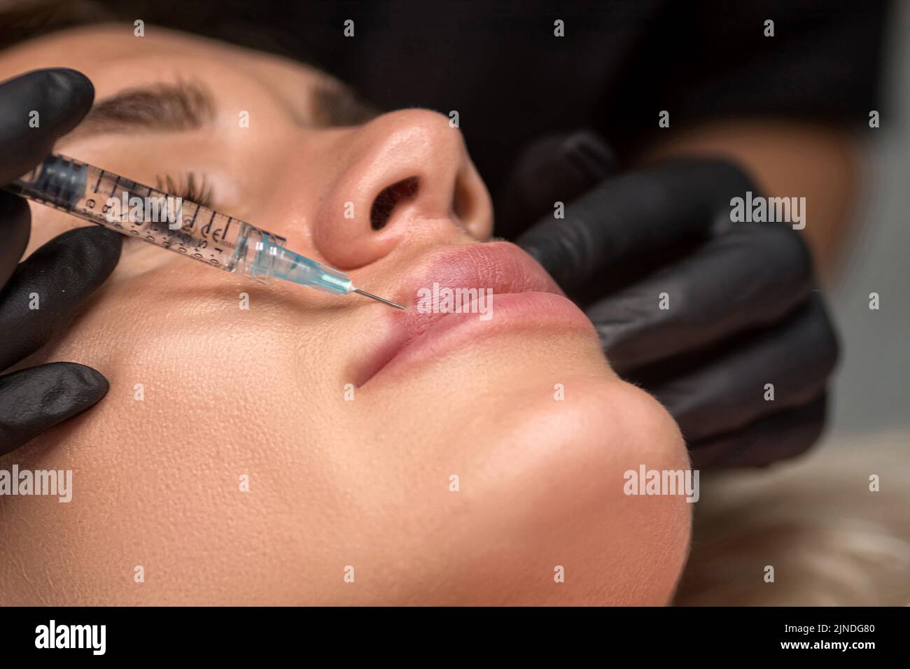 Woman getting cosmetic injection of botulinum to lips. Lip augmentation procedure in a beauty salon. Focus on lips Stock Photo