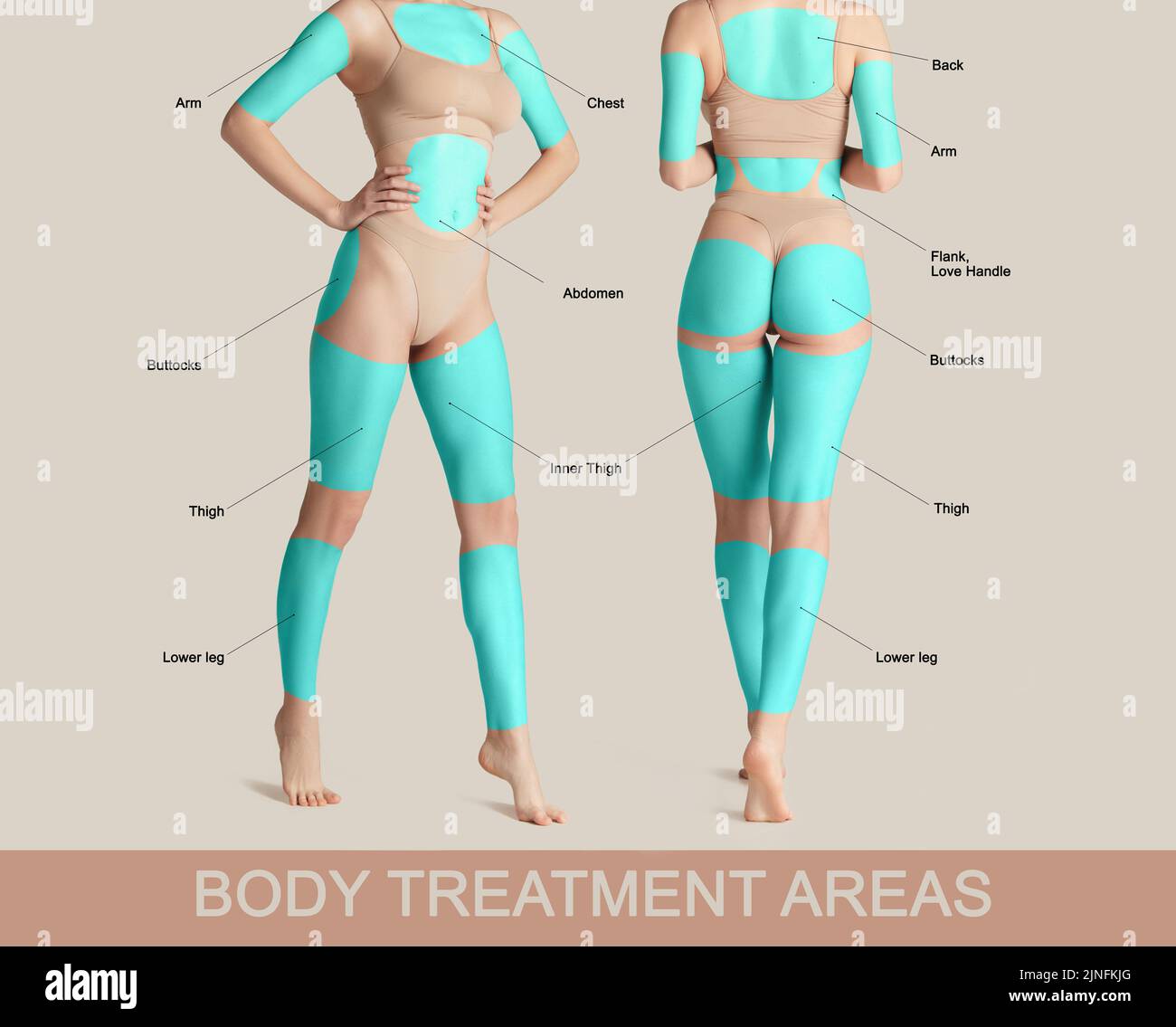 Poster with female body with marked areas for lifting procedures. Base fat problems areas of human body. Stock Photo