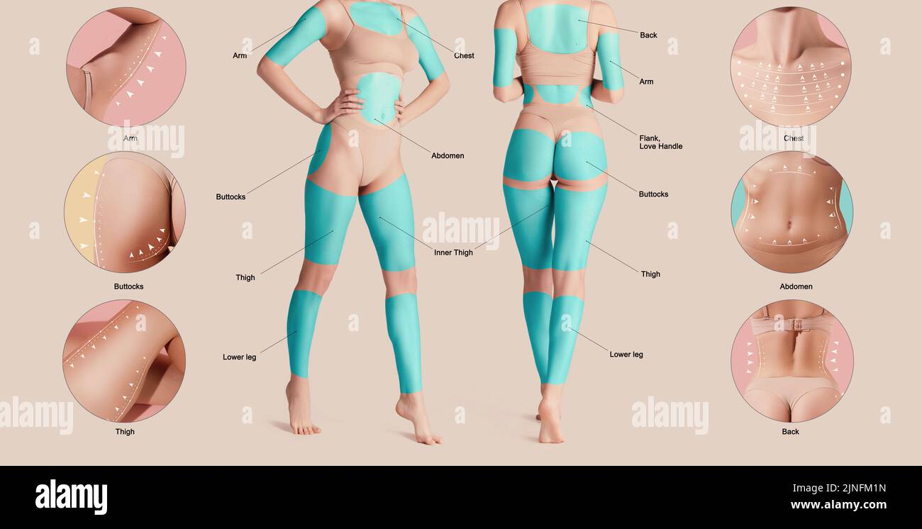 Poster with female body with marked areas for lifting procedures. Base fat problems areas of human body. Stock Photo