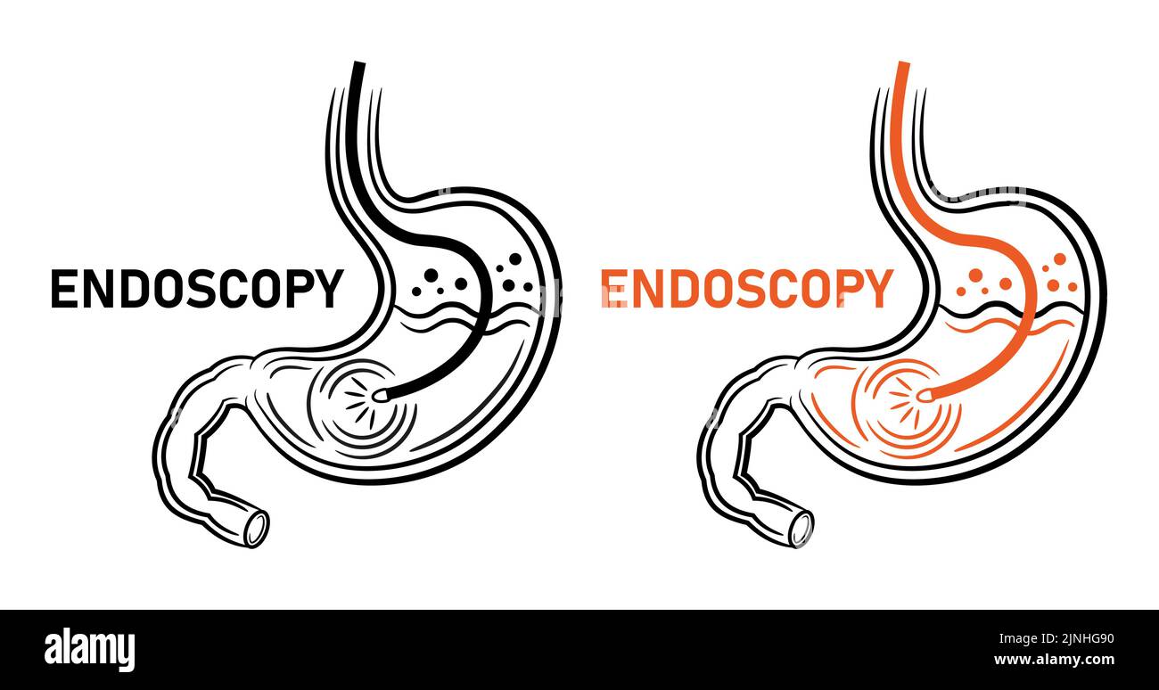 Endoscopy stomach, endoscope, gastroscopy gastrointestinal medical diagnostic  line icon. Gastroenterology. Gastritis, ulcer. Intestinal tract. Vector Stock Vector