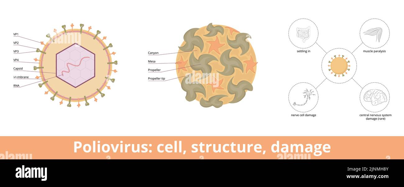 Poliovirus: cell, structure, damage.Viral cell: RNA genome and a protein capsid, glycoproteins. Main pathophysiology characteristics. Stock Vector