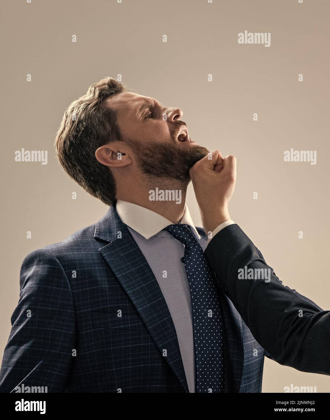 Got punched in face. Professional man punched by colleague. Fighting