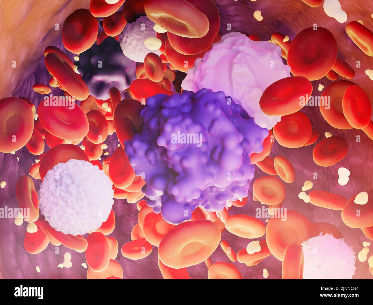 Blood cells with circulating tumor cells, illustration Stock Photo