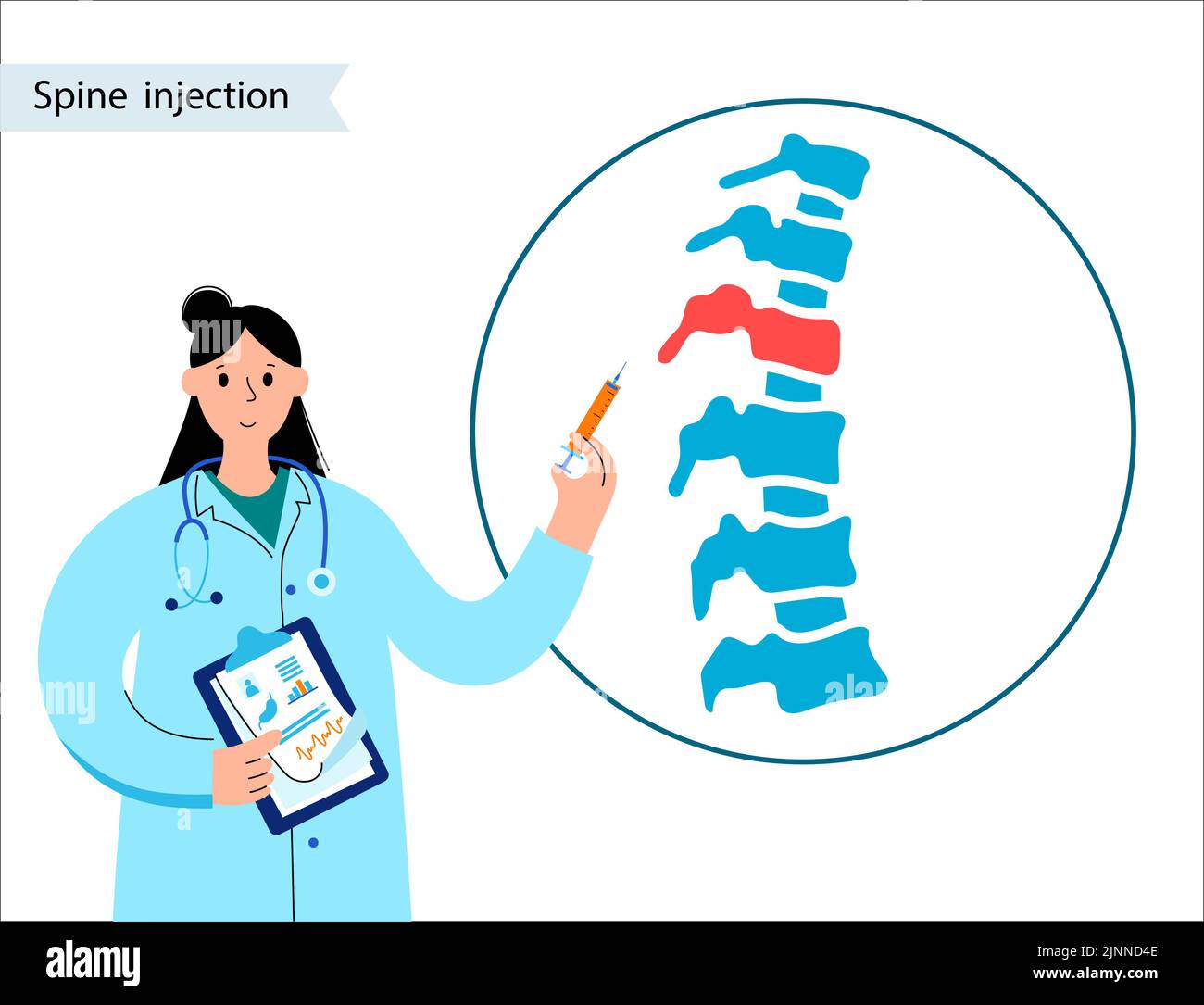 Spinal injection, illustration Stock Photo Alamy