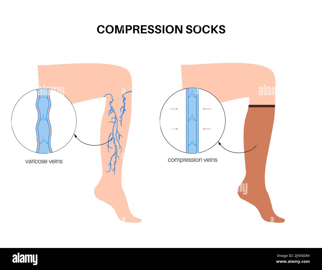 Compression socks for varicose veins, illustration Stock Photo