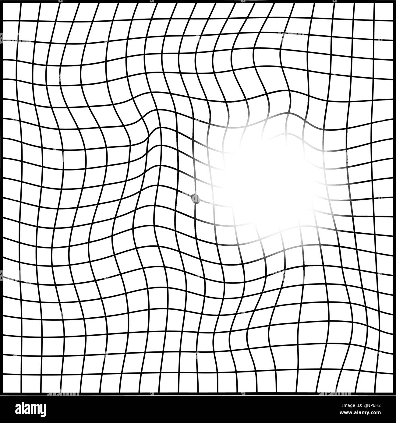 Amsler chart, Agerelated macular degeneration visibility (visual field