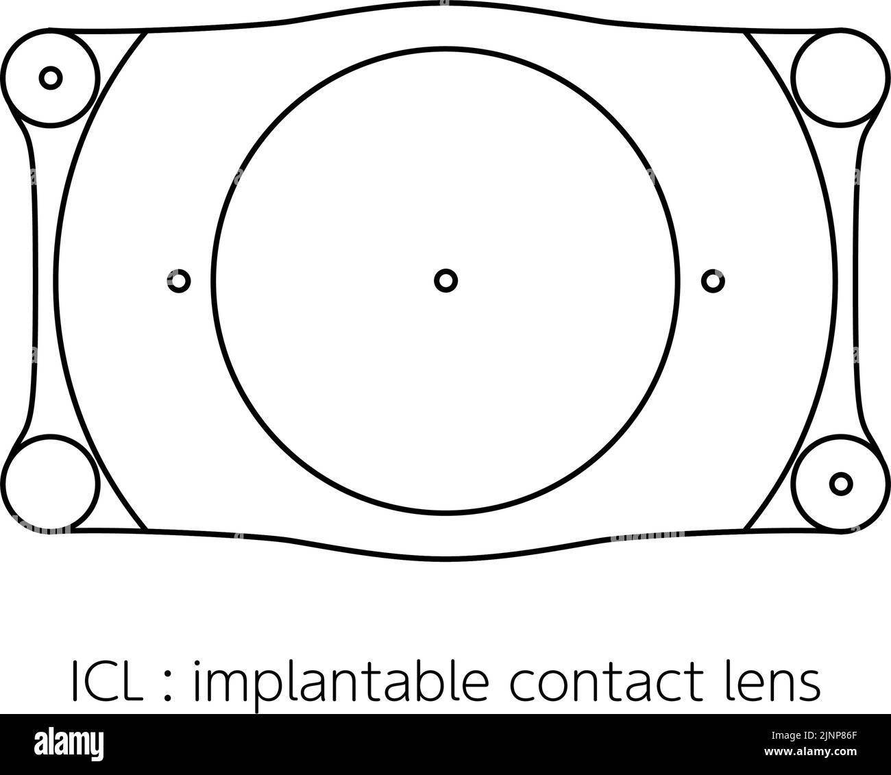 ICL, intraocular contact lens illustration Stock Vector