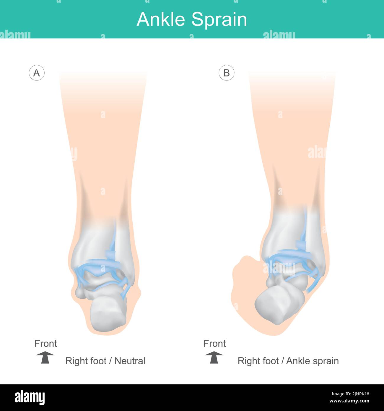 Ankle Bones of Human. Correct position ankle bones of human. Illustration health care. Stock Vector