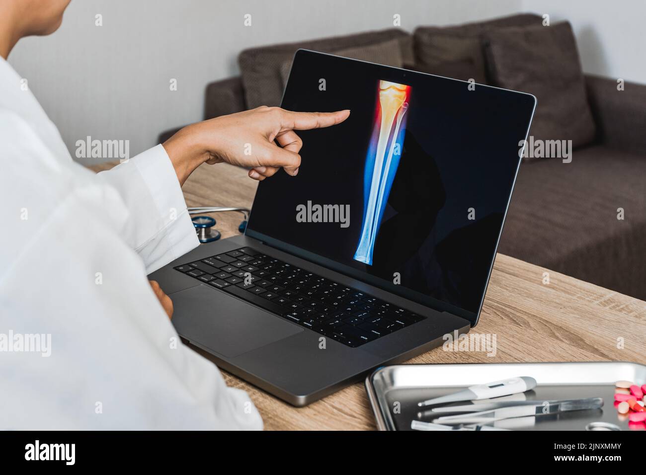 Close up of doctor showing a x-ray of pain in the knee Stock Photo