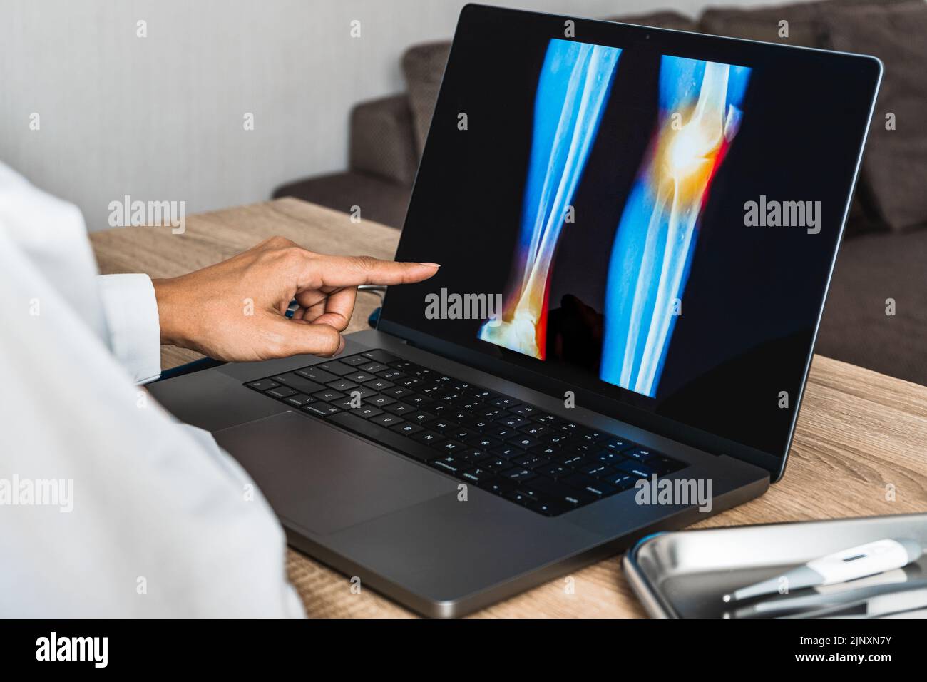 Close up of doctor showing a x-ray of pain in the knee Stock Photo