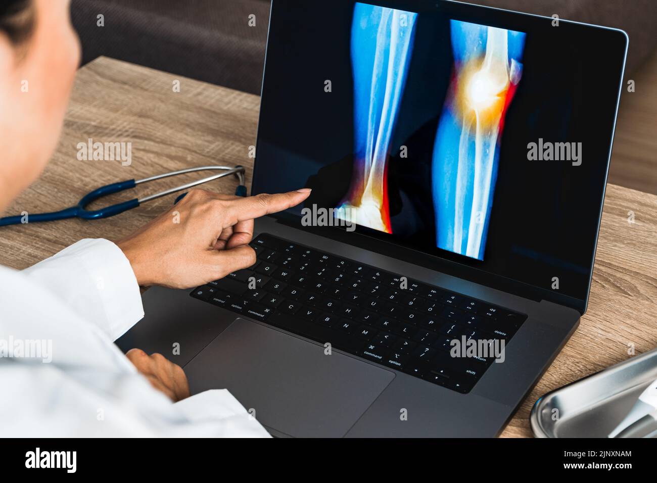 Close up of doctor showing a x-ray of pain in the knee Stock Photo