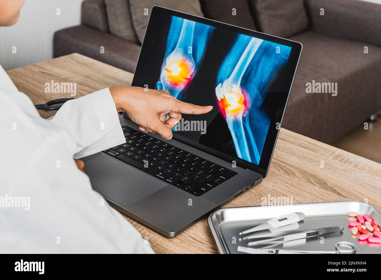 Close up of doctor showing a x-ray of pain in the knee Stock Photo