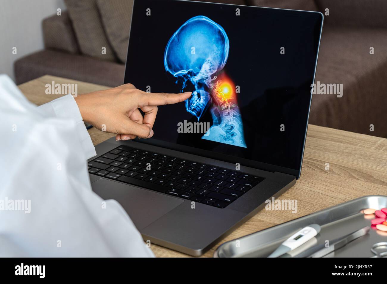 Doctor showing a xray of pain in the neck. Migraine Headache and