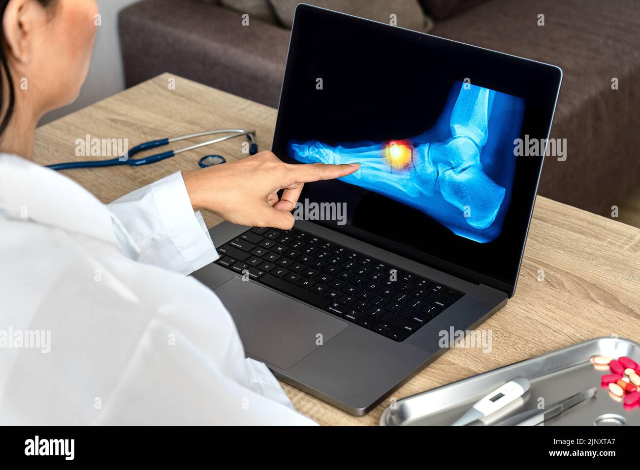 Close up of doctor showing a xray of foot. Pain foot injury Stock