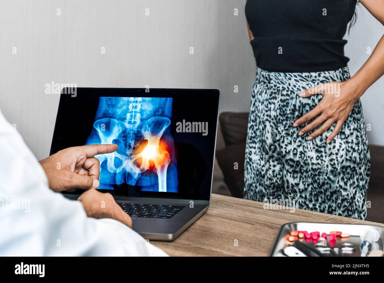 Doctor showing a x-ray of pain in the hips on a laptop. Woman patient in the background Stock Photo