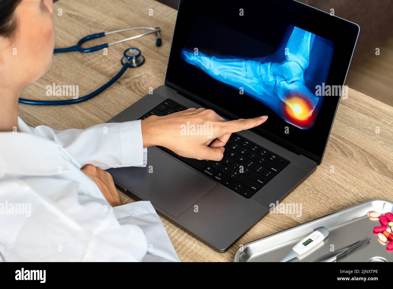 Close up of doctor showing a x-ray of foot. Pain heel and foot injury Stock Photo