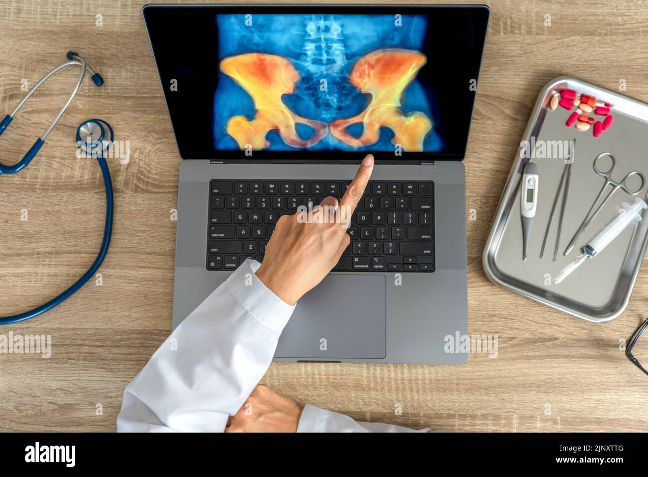 Top view of doctor showing a xray of pain in the hips on a laptop