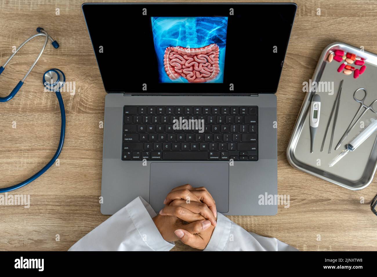 Top view of doctor looking a x-ray of stomach and intestine Stock Photo