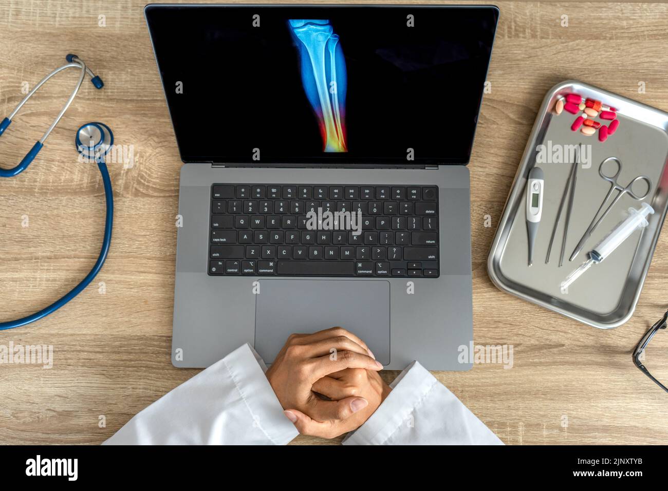 Top view of doctor looking a xray of foot. Pain ankle injury Stock