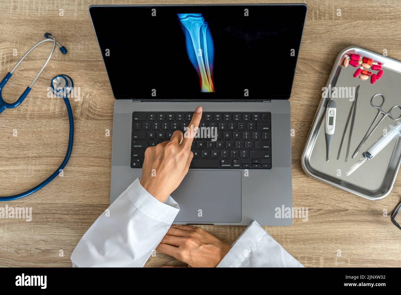 Top view of doctor showing a xray of foot. Pain ankle injury Stock