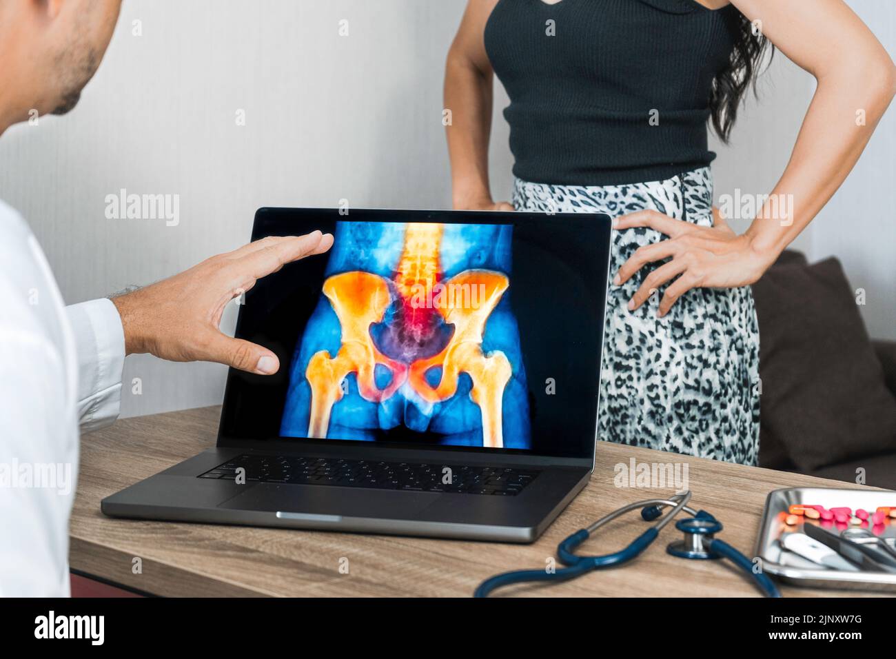 Doctor showing a x-ray of pain in the hips on a laptop. Woman patient in the background Stock Photo