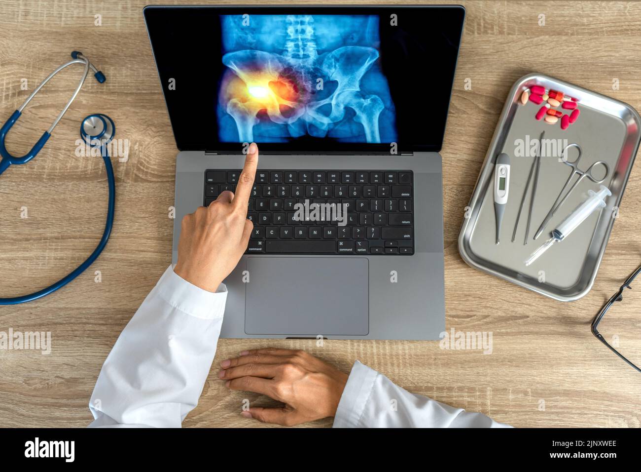 Top view of doctor looking a xray of pain in the hips on a laptop
