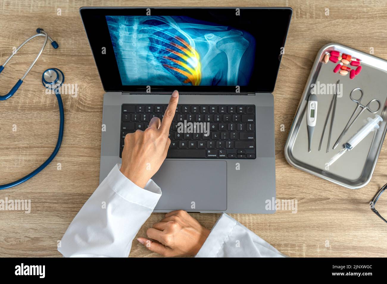 Top view of Doctor showing a xray of pain in the ribs. Heart attack or