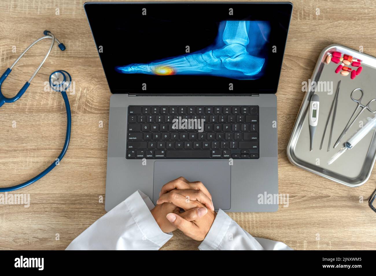 Top view of doctor looking a x-ray of foot. Pain injury Stock Photo