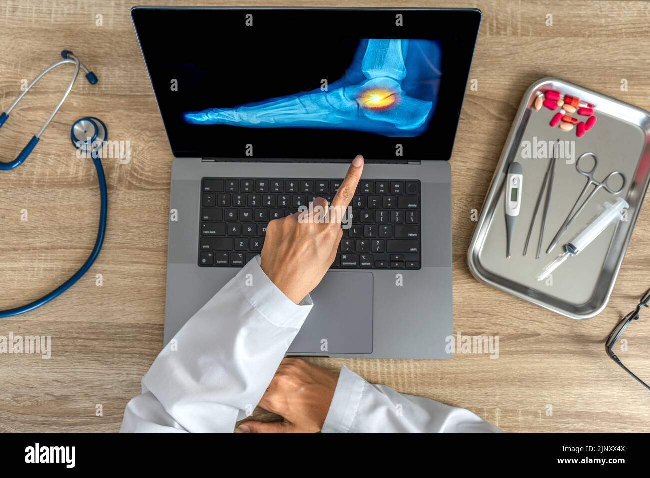 Top view of doctor showing a xray of foot. Pain ankle injury Stock