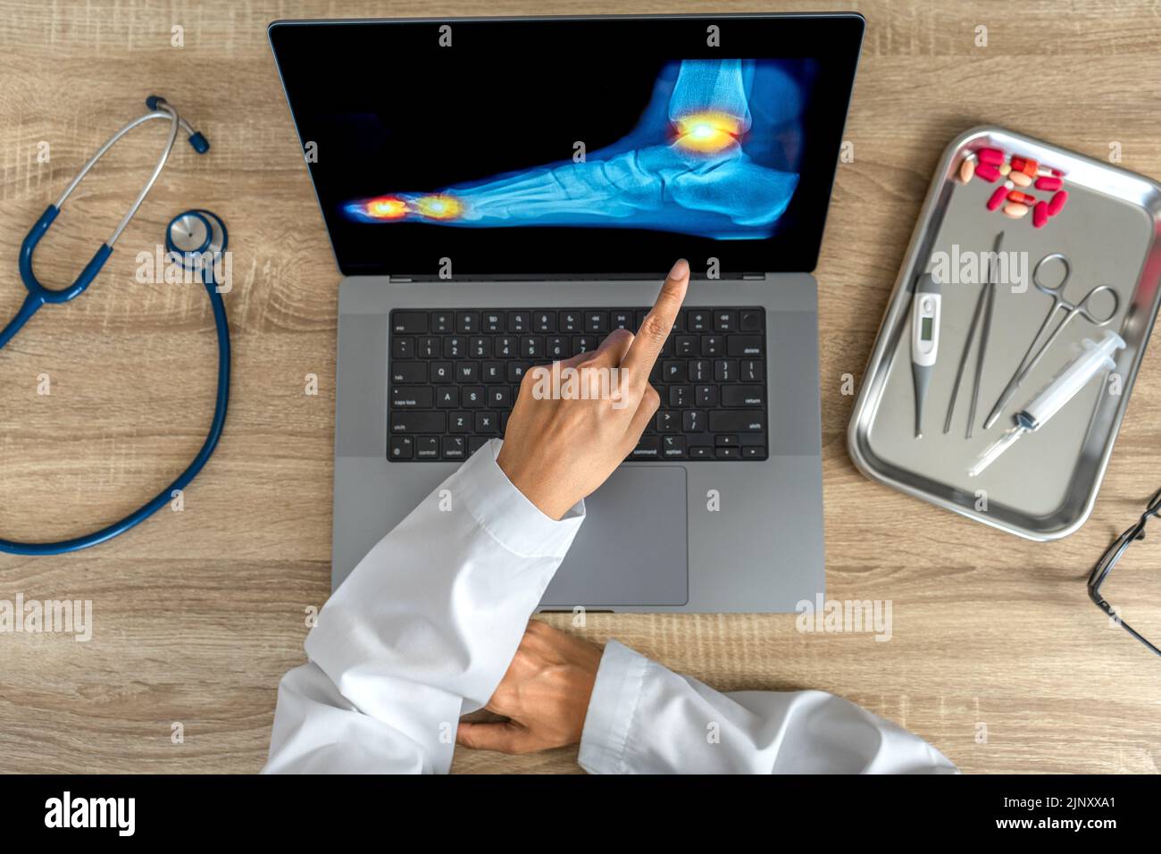 Close up of doctor showing a xray of foot. Pain ankle and toes injury