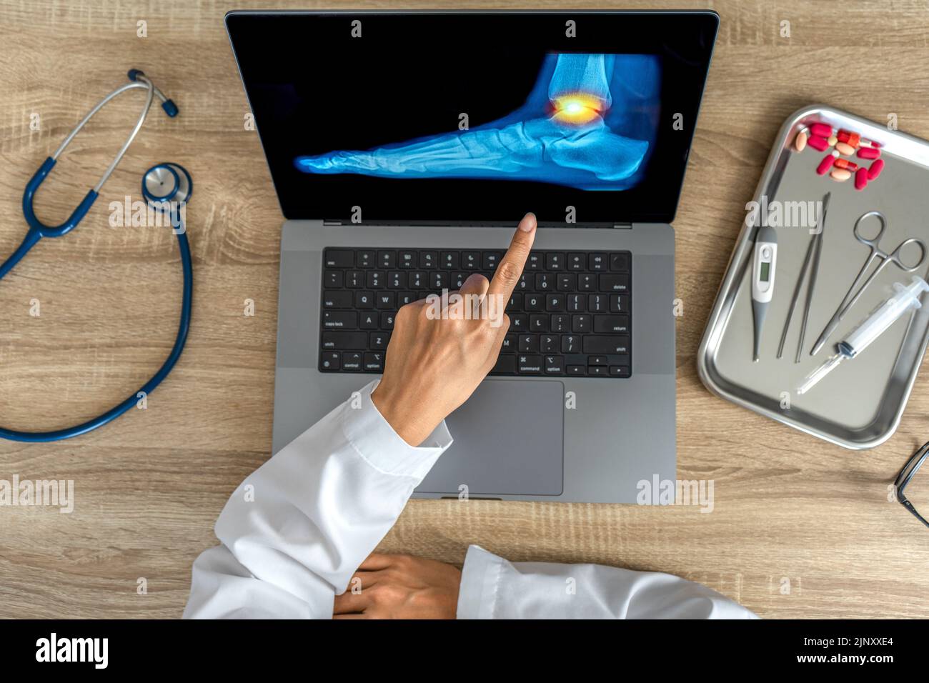Top view of doctor showing a xray of foot. Pain ankle injury Stock