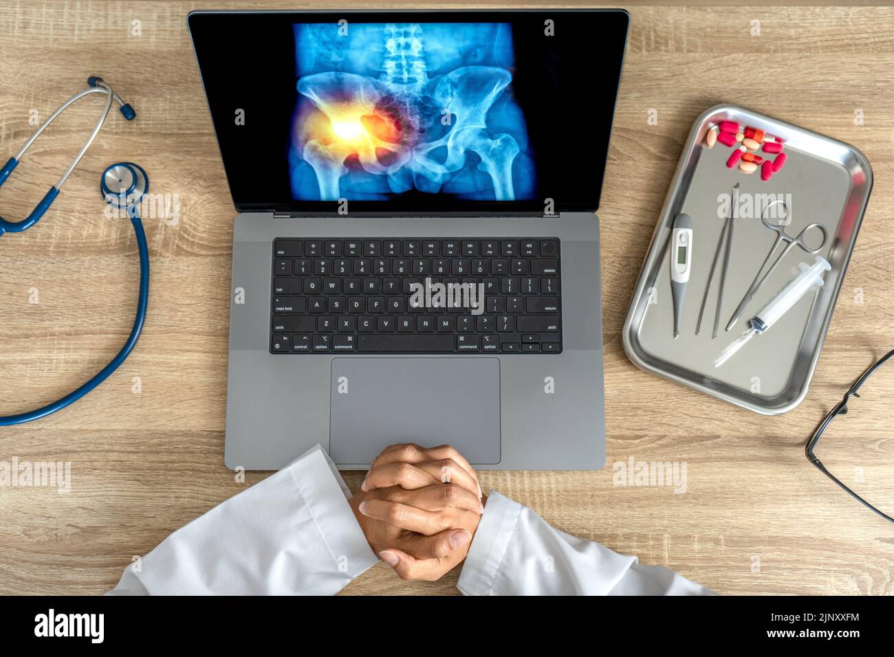 Top view of doctor looking a xray of pain in the hips on a laptop