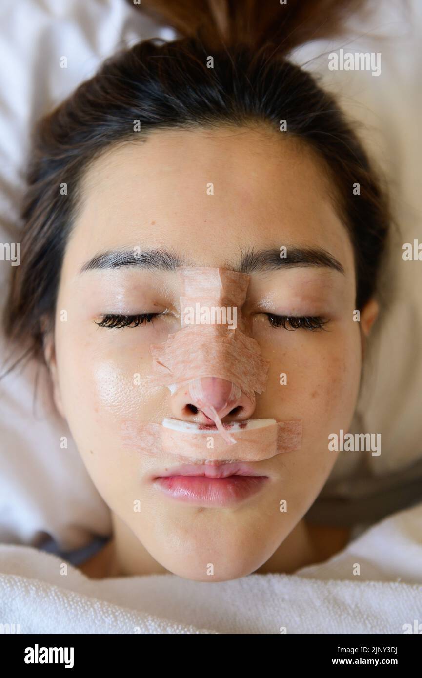Portrait of woman with bandage on her nose after rhinoplasty Stock Photo