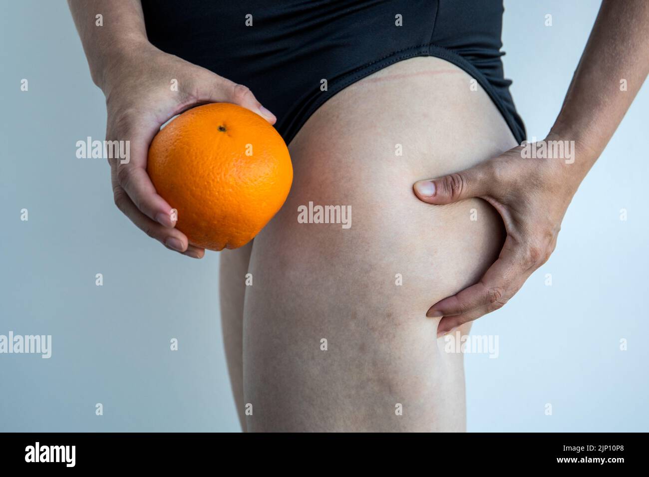 Female thighs and orange in hands. Concept of skin problems and beauty standards. Stock Photo