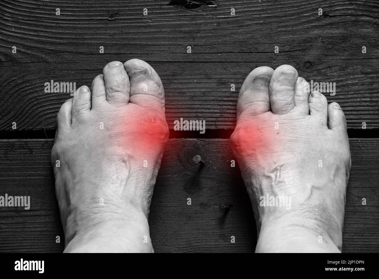 Legs of an elderly woman on the floor with red spots where there are