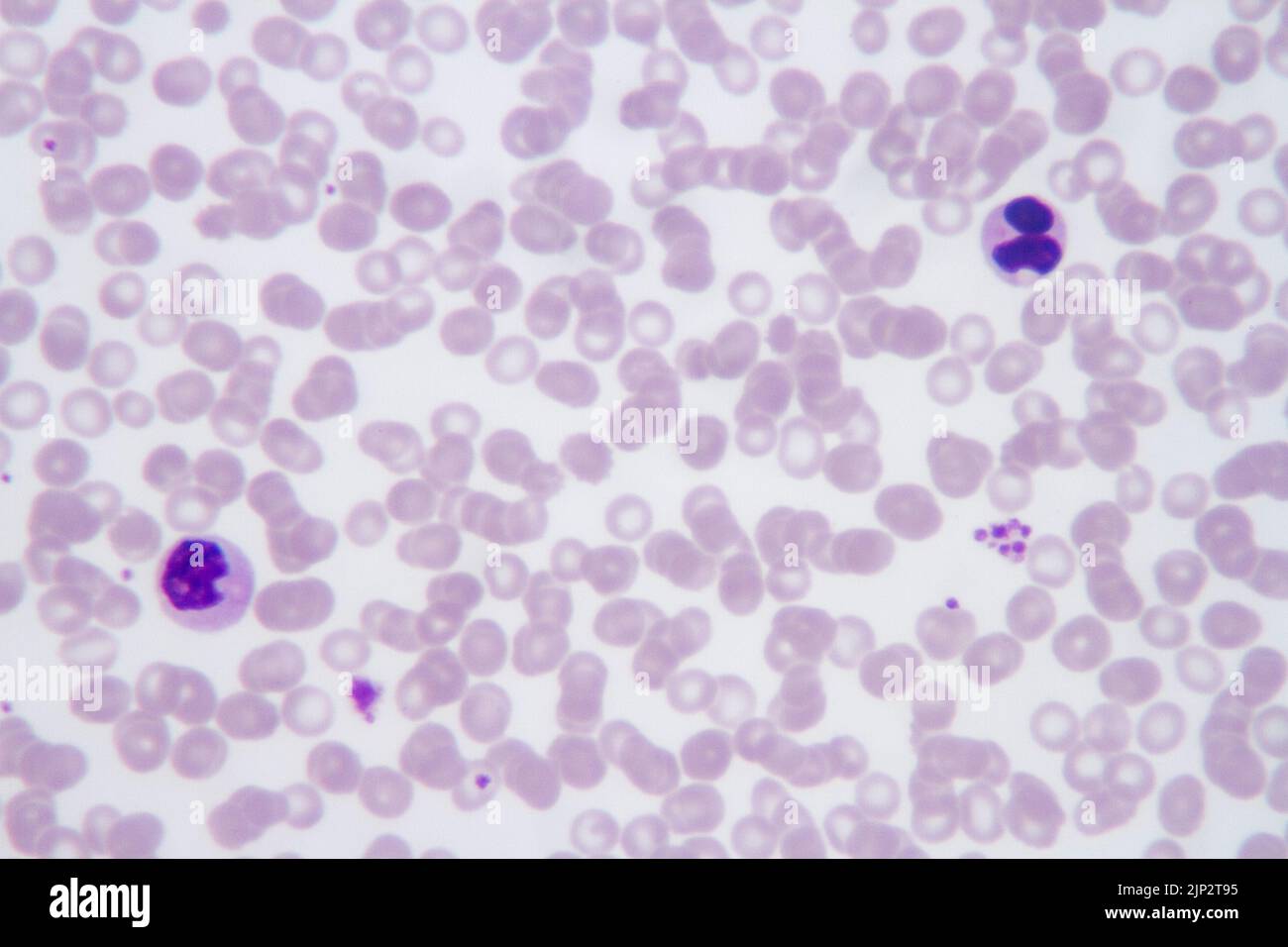 Plasmodium Under Microscope 400x