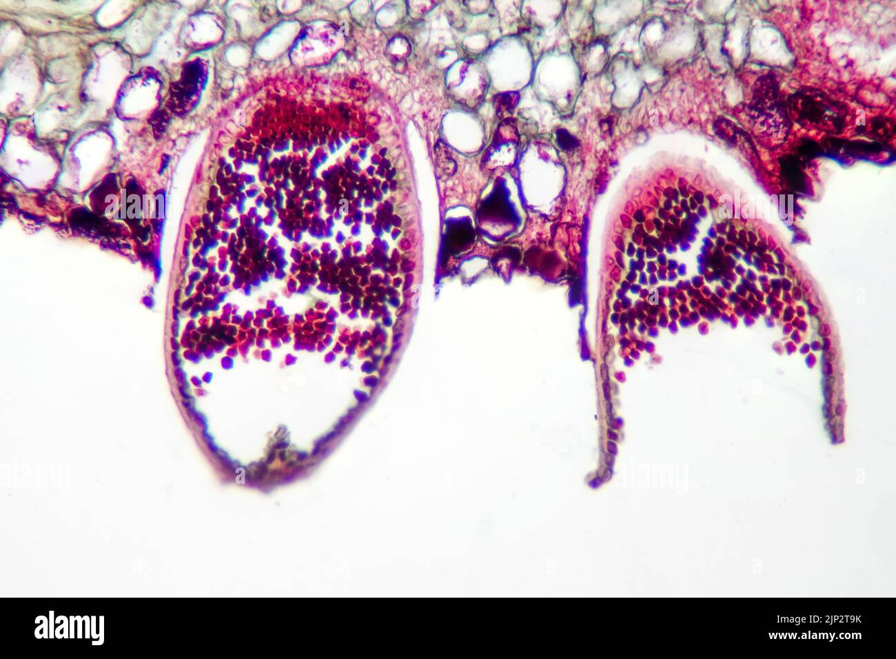 Parasitic plant fungus Puccinia microscope slide. Stock Photo