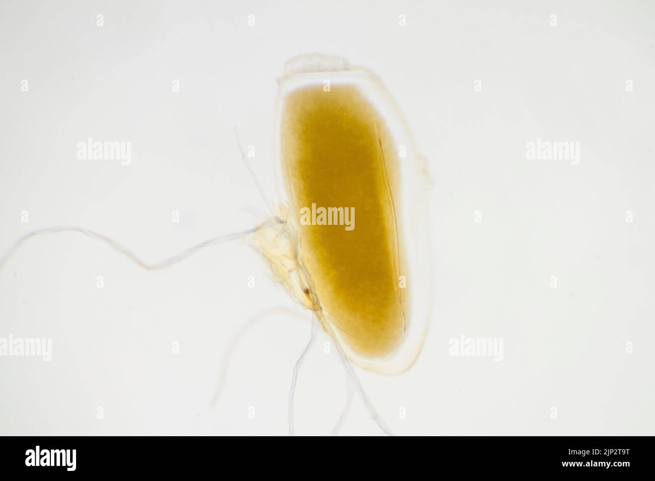 Pediculus humanus corporis egg. Microscope view of the body louse egg. Stock Photo